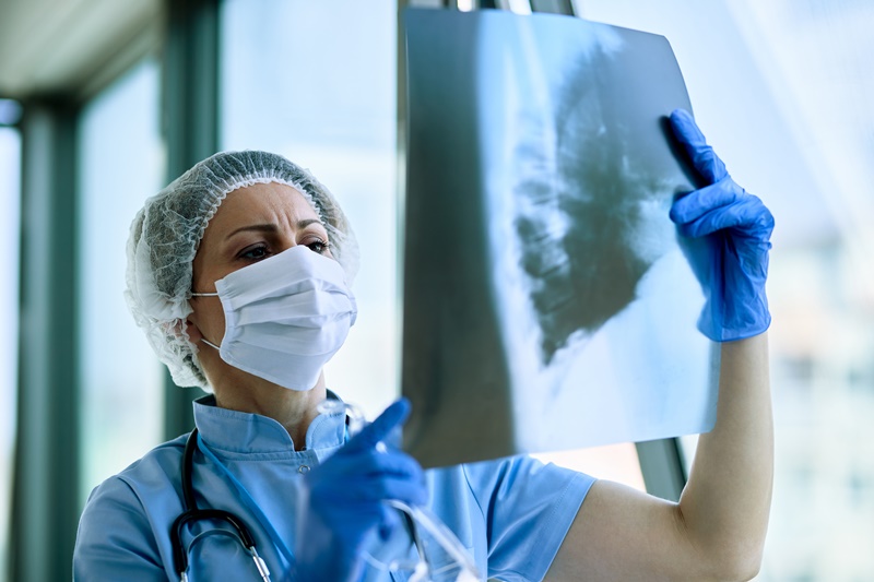 Female radiologist analyzing chest X-ray of an patient at medical clinic during coronavirus epidemic.